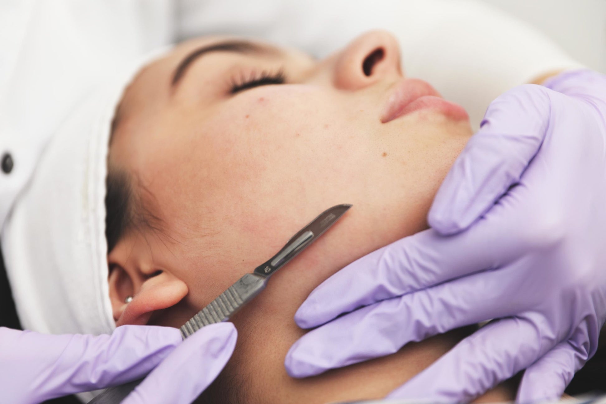 Dermaplane Only