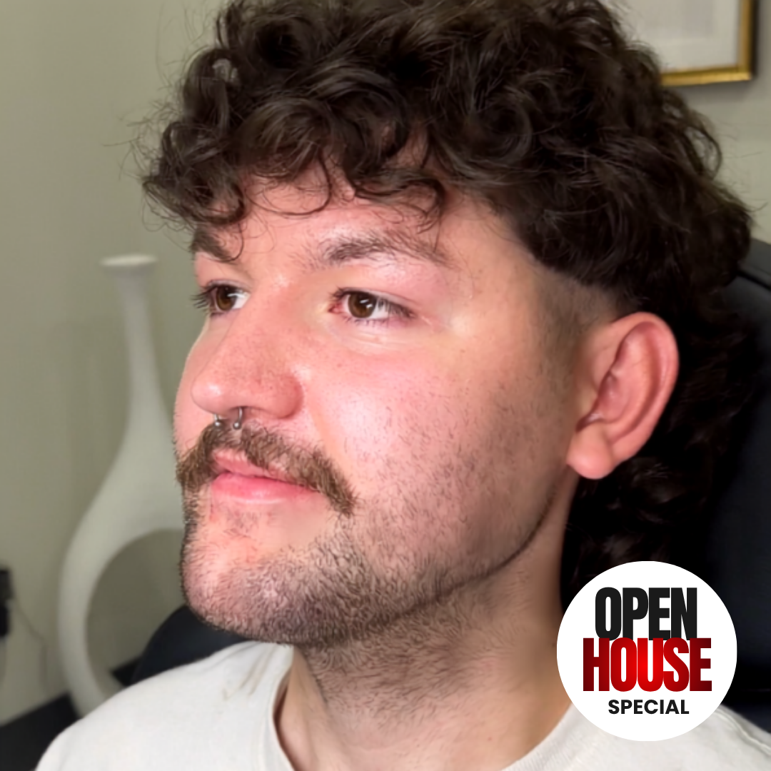 INJECTABLES: MALE JAWLINE FILLER + 30 UNITS OF TOX