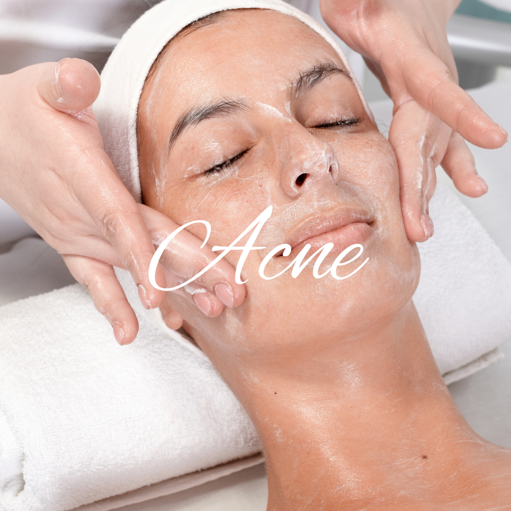 PRISM ACNE FACIAL: 60 MINUTE