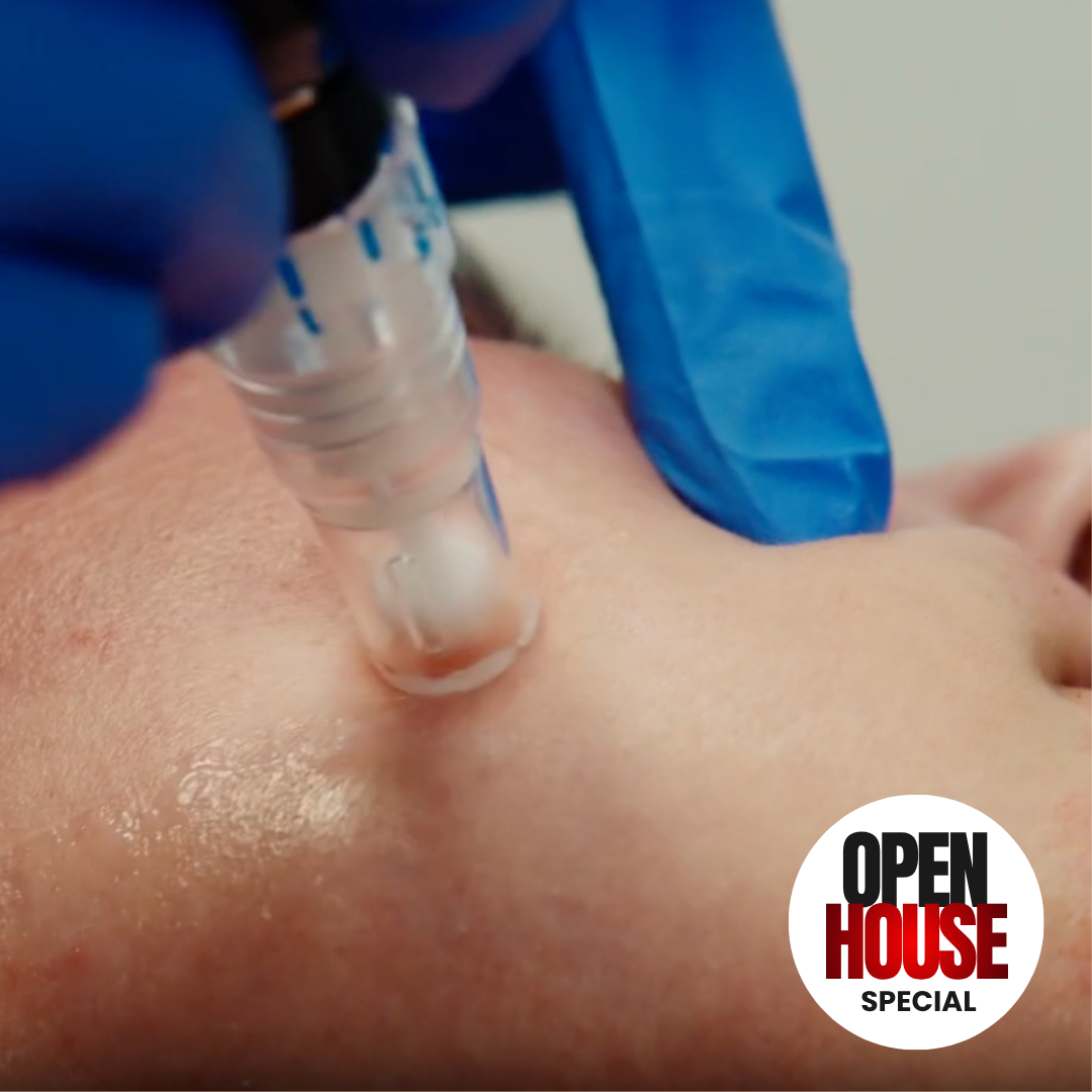 SKINPEN MICRONEEDLING